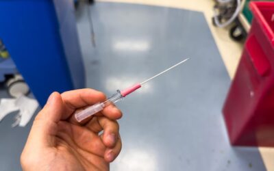 Jak długo utrzymuje się znieczulenie po usunięciu ósemki?