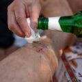 Czy zabieg abrazji wiąże się z bólem podczas i po zabiegu?